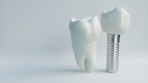 dental implant in Vienna with crown next to natural tooth