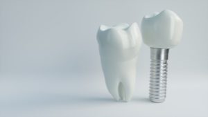 dental implant in Vienna with crown next to natural tooth 